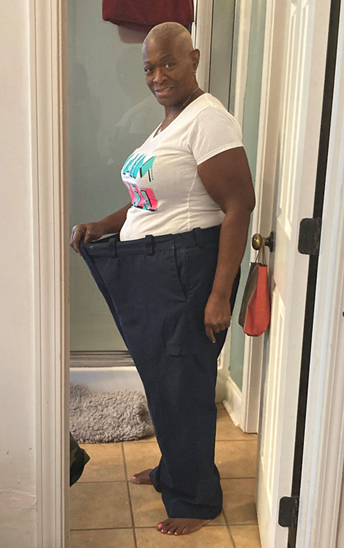 Photo of Carolyn Polk standing sideways holding the waistband of her pants away from her body.